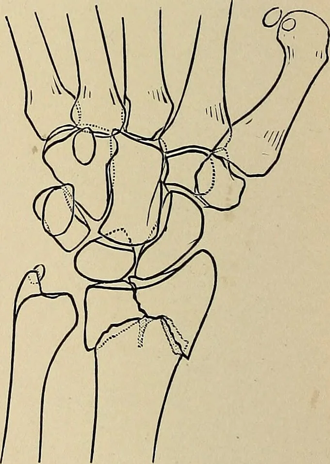 An illustration from Surgical diagnosis / by Edward Martin ... illustrated with 445 engravings and 18 plates in colors and monochrome., 1909, leaf 408
