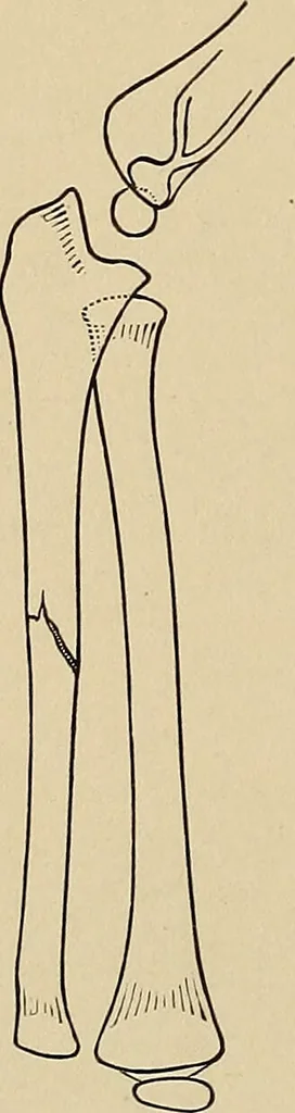 An illustration from Surgical diagnosis / by Edward Martin ... illustrated with 445 engravings and 18 plates in colors and monochrome., 1909, leaf 422