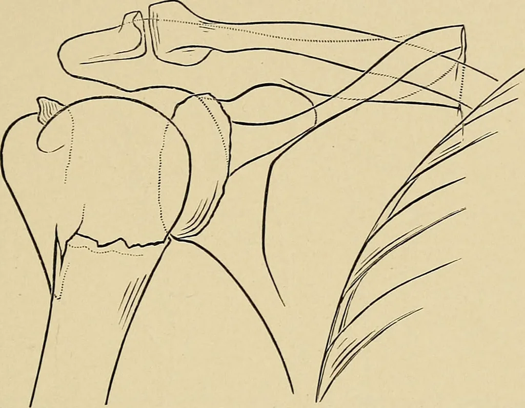An illustration from Surgical diagnosis / by Edward Martin ... illustrated with 445 engravings and 18 plates in colors and monochrome., 1909, leaf 461