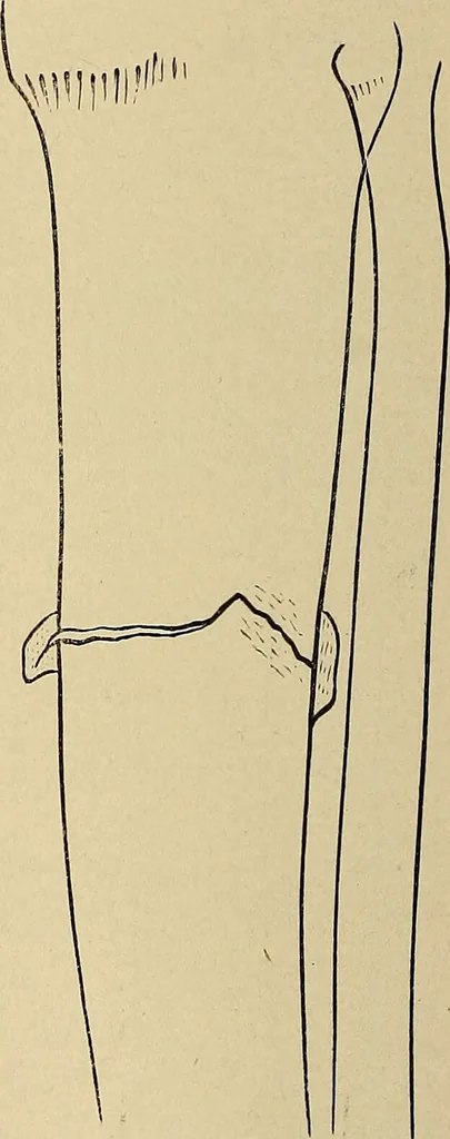 An illustration from Surgical diagnosis / by Edward Martin ... illustrated with 445 engravings and 18 plates in colors and monochrome., 1909, leaf 622