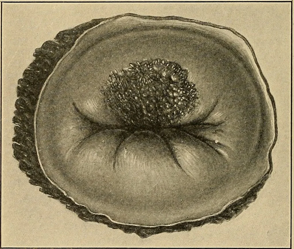 An illustration from Surgical diagnosis / by Edward Martin ... illustrated with 445 engravings and 18 plates in colors and monochrome., 1909, leaf 754