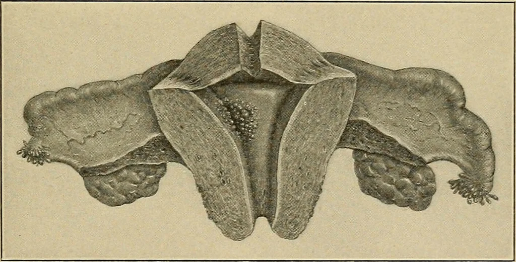 An illustration from Surgical diagnosis / by Edward Martin ... illustrated with 445 engravings and 18 plates in colors and monochrome., 1909, leaf 759