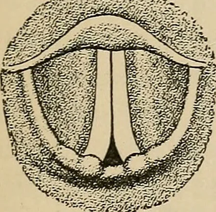 An illustration from Atlas of methods of clinical investigation : with an epitome of clinical diagnosis and of special pathology and treatment of internal diseases / By Dr. Christfried Jakob ... Authorized translation from the German. Ed. by Augustus A. Eshner ... With 182 colored illustrations upon 68 plates, and 64 illustrations in the text., 1898, leaf 267