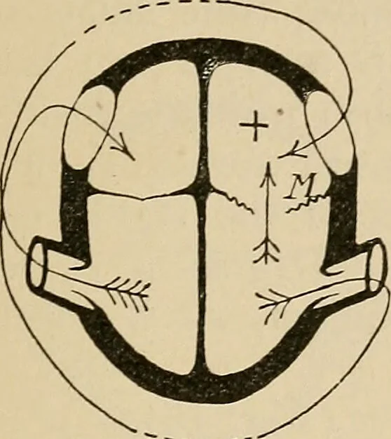 An illustration from Atlas of methods of clinical investigation : with an epitome of clinical diagnosis and of special pathology and treatment of internal diseases / By Dr. Christfried Jakob ... Authorized translation from the German. Ed. by Augustus A. Eshner ... With 182 colored illustrations upon 68 plates, and 64 illustrations in the text., 1898, leaf 285