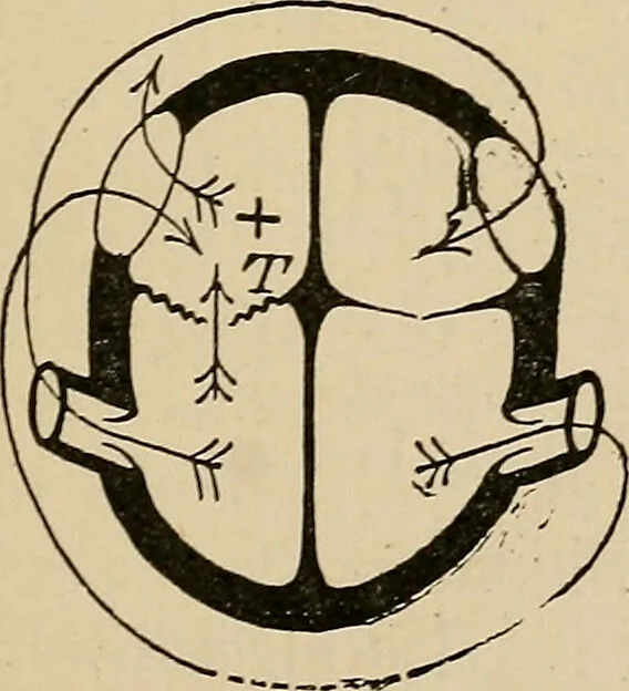 An illustration from Atlas of methods of clinical investigation : with an epitome of clinical diagnosis and of special pathology and treatment of internal diseases / By Dr. Christfried Jakob ... Authorized translation from the German. Ed. by Augustus A. Eshner ... With 182 colored illustrations upon 68 plates, and 64 illustrations in the text., 1898, leaf 287