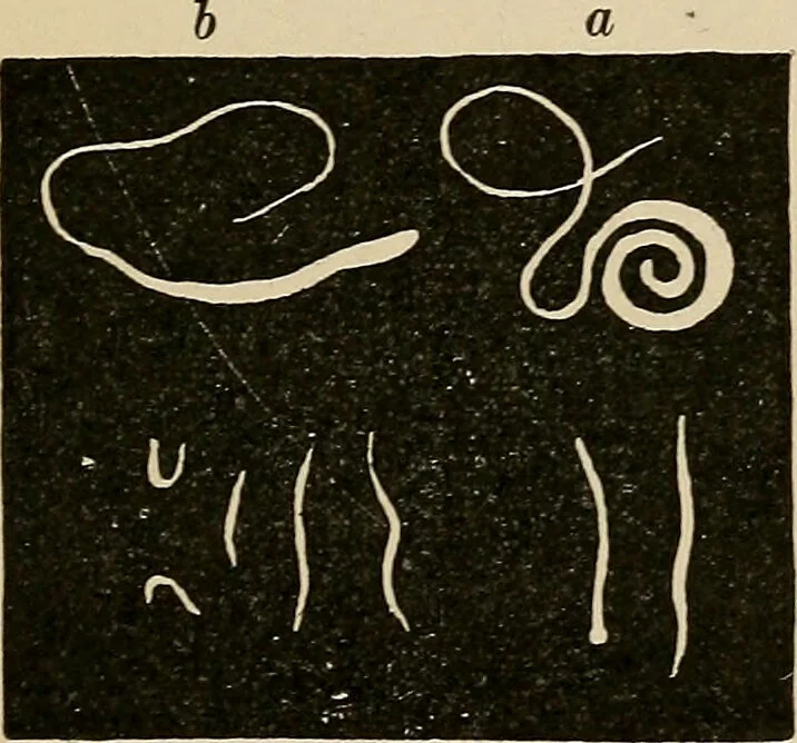An illustration from Atlas of methods of clinical investigation : with an epitome of clinical diagnosis and of special pathology and treatment of internal diseases / By Dr. Christfried Jakob ... Authorized translation from the German. Ed. by Augustus A. Eshner ... With 182 colored illustrations upon 68 plates, and 64 illustrations in the text., 1898, leaf 355