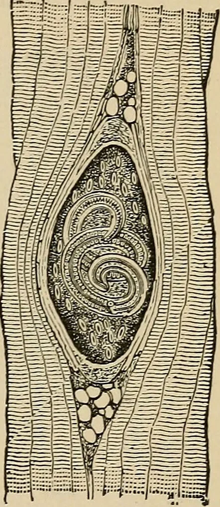An illustration from Atlas of methods of clinical investigation : with an epitome of clinical diagnosis and of special pathology and treatment of internal diseases / By Dr. Christfried Jakob ... Authorized translation from the German. Ed. by Augustus A. Eshner ... With 182 colored illustrations upon 68 plates, and 64 illustrations in the text., 1898, leaf 355