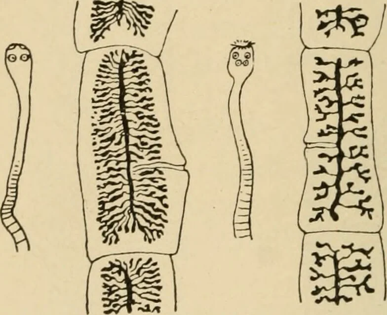 An illustration from Atlas of methods of clinical investigation : with an epitome of clinical diagnosis and of special pathology and treatment of internal diseases / By Dr. Christfried Jakob ... Authorized translation from the German. Ed. by Augustus A. Eshner ... With 182 colored illustrations upon 68 plates, and 64 illustrations in the text., 1898, leaf 356
