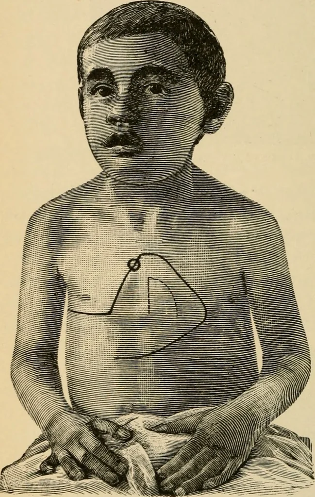 An illustration from Atlas of methods of clinical investigation : with an epitome of clinical diagnosis and of special pathology and treatment of internal diseases / By Dr. Christfried Jakob ... Authorized translation from the German. Ed. by Augustus A. Eshner ... With 182 colored illustrations upon 68 plates, and 64 illustrations in the text., 1898, leaf 410