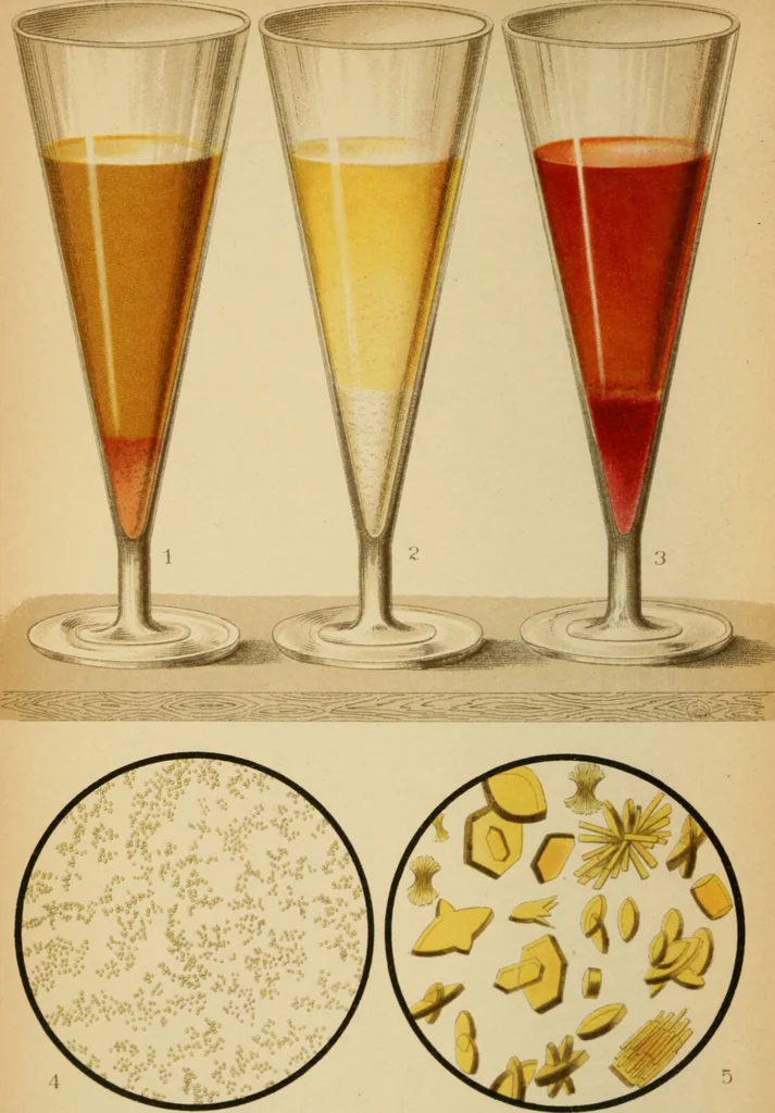 An illustration from Atlas of methods of clinical investigation : with an epitome of clinical diagnosis and of special pathology and treatment of internal diseases / By Dr. Christfried Jakob ... Authorized translation from the German. Ed. by Augustus A. Eshner ... With 182 colored illustrations upon 68 plates, and 64 illustrations in the text., 1898, leaf 58