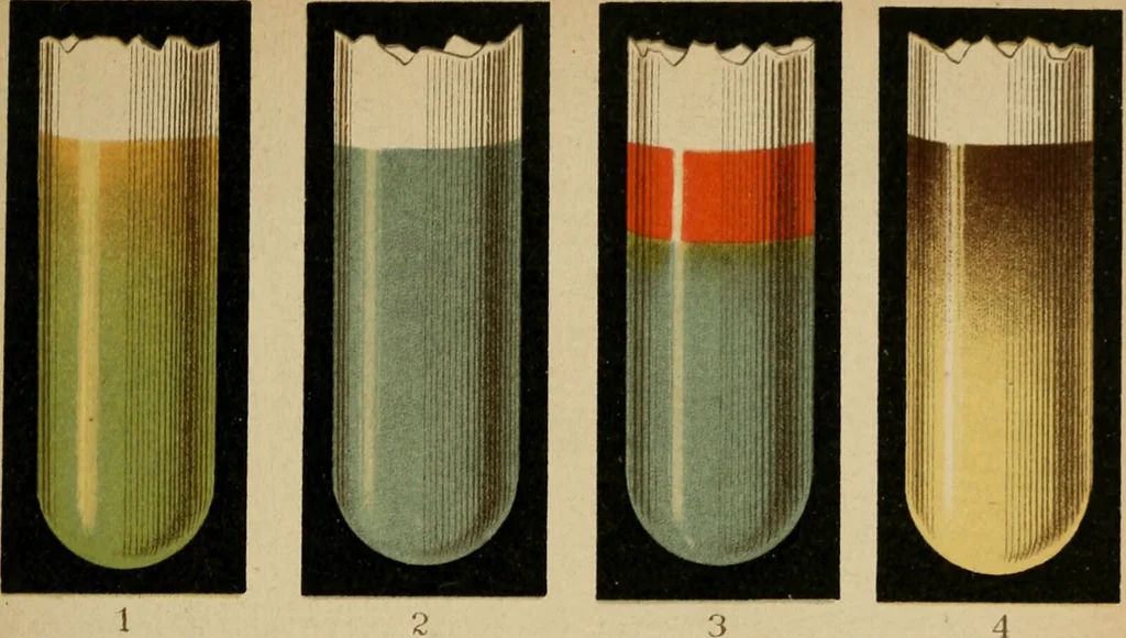 An illustration from Atlas of methods of clinical investigation : with an epitome of clinical diagnosis and of special pathology and treatment of internal diseases / By Dr. Christfried Jakob ... Authorized translation from the German. Ed. by Augustus A. Eshner ... With 182 colored illustrations upon 68 plates, and 64 illustrations in the text., 1898, leaf 77