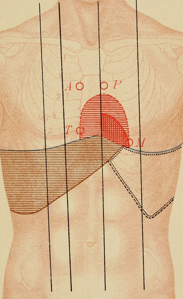 An illustration from Atlas of methods of clinical investigation : with an epitome of clinical diagnosis and of special pathology and treatment of internal diseases / By Dr. Christfried Jakob ... Authorized translation from the German. Ed. by Augustus A. Eshner ... With 182 colored illustrations upon 68 plates, and 64 illustrations in the text., 1898, leaf 91