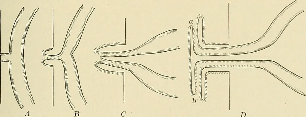 An illustration from The diseases of infancy and childhood : for the use of students and practitioners of medicine / by L. Emmett Holt and John Howland., 1911, leaf 139