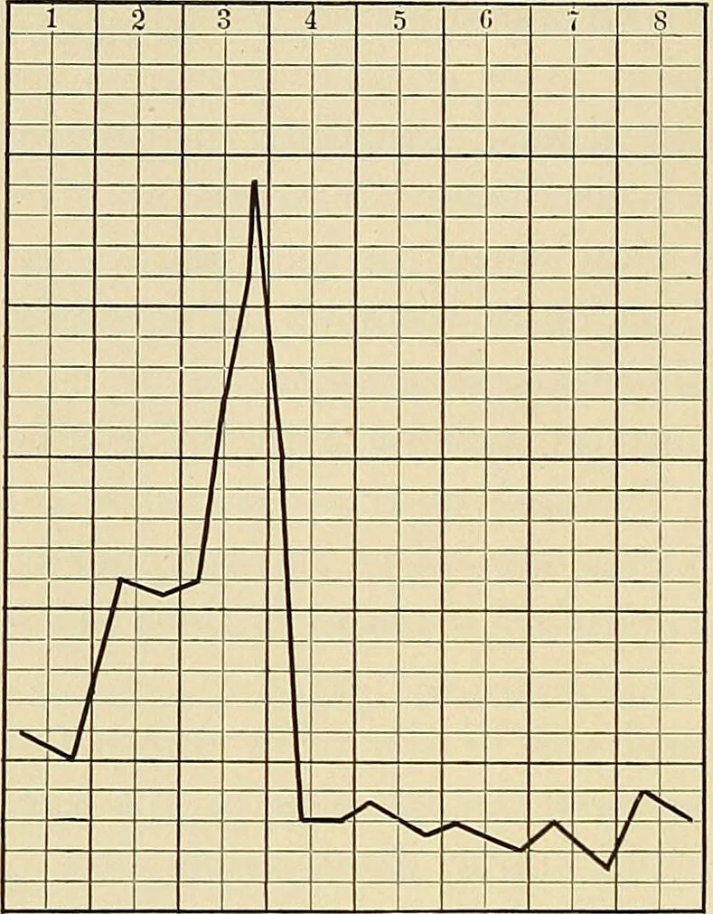 An illustration from The diseases of infancy and childhood : for the use of students and practitioners of medicine / by L. Emmett Holt and John Howland., 1911, leaf 148