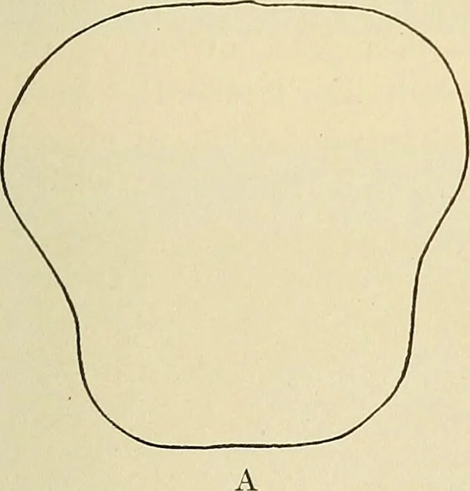An illustration from The diseases of infancy and childhood : for the use of students and practitioners of medicine / by L. Emmett Holt and John Howland., 1911, leaf 285