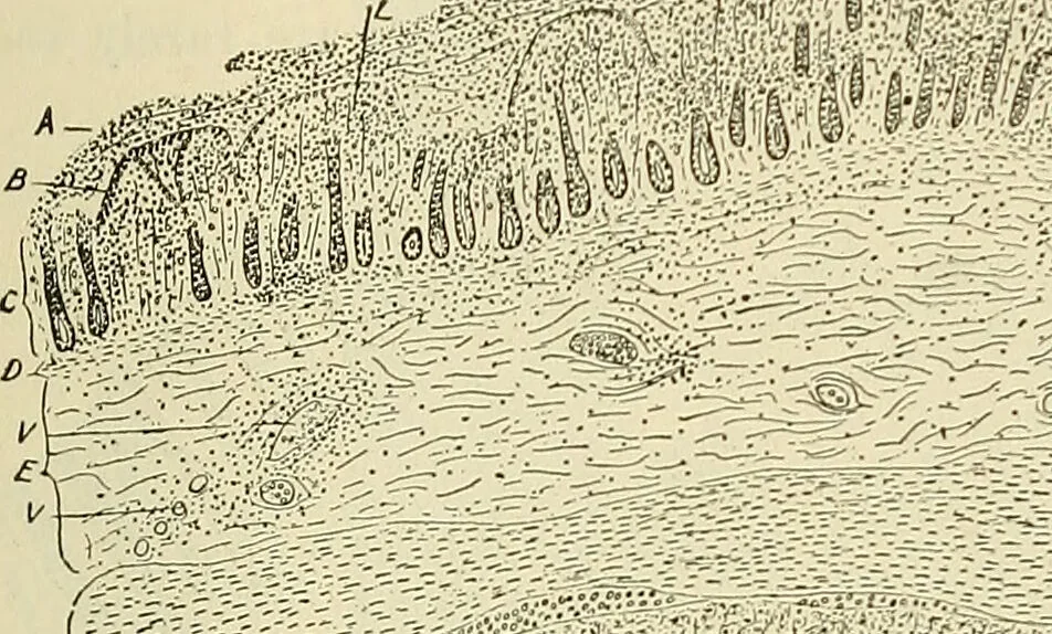 An illustration from The diseases of infancy and childhood : for the use of students and practitioners of medicine / by L. Emmett Holt and John Howland., 1911, leaf 409