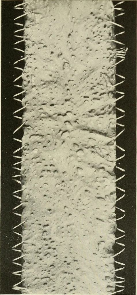 An illustration from The diseases of infancy and childhood : for the use of students and practitioners of medicine / by L. Emmett Holt and John Howland., 1911, leaf 411