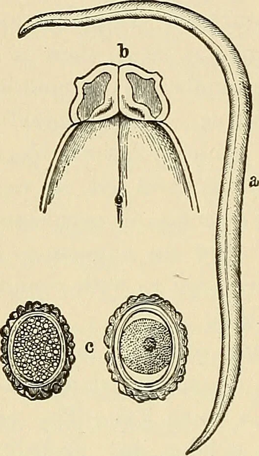 An illustration from The diseases of infancy and childhood : for the use of students and practitioners of medicine / by L. Emmett Holt and John Howland., 1911, leaf 466