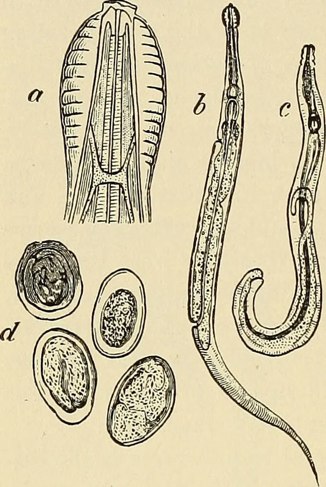 An illustration from The diseases of infancy and childhood : for the use of students and practitioners of medicine / by L. Emmett Holt and John Howland., 1911, leaf 468