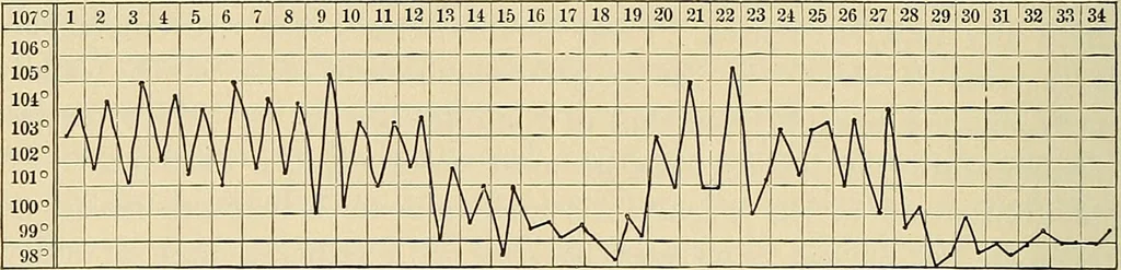 An illustration from The diseases of infancy and childhood : for the use of students and practitioners of medicine / by L. Emmett Holt and John Howland., 1911, leaf 552