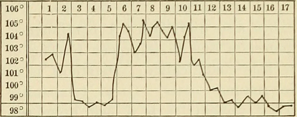 An illustration from The diseases of infancy and childhood : for the use of students and practitioners of medicine / by L. Emmett Holt and John Howland., 1911, leaf 573