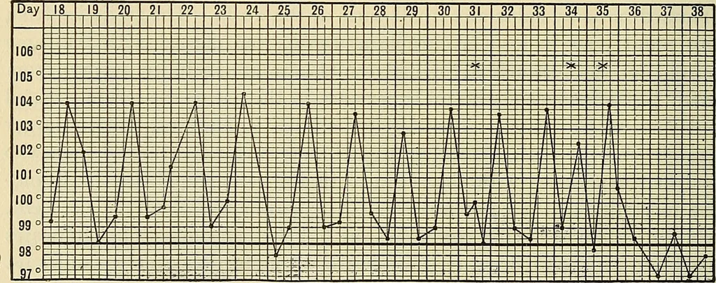 An illustration from The diseases of infancy and childhood : for the use of students and practitioners of medicine / by L. Emmett Holt and John Howland., 1911, leaf 764