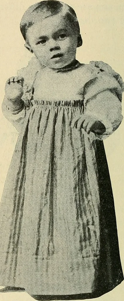 An illustration from The diseases of infancy and childhood : for the use of students and practitioners of medicine / by L. Emmett Holt and John Howland., 1911, leaf 820