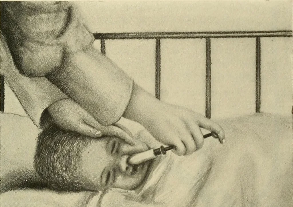 An illustration from The diseases of infancy and childhood : for the use of students and practitioners of medicine / by L. Emmett Holt and John Howland., 1911, leaf 85