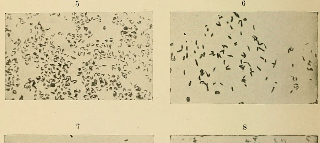 An illustration from The diseases of infancy and childhood : for the use of students and practitioners of medicine / by L. Emmett Holt with two hundred and forty-one illustrations, including eight coloured plates., 1908, leaf 1090