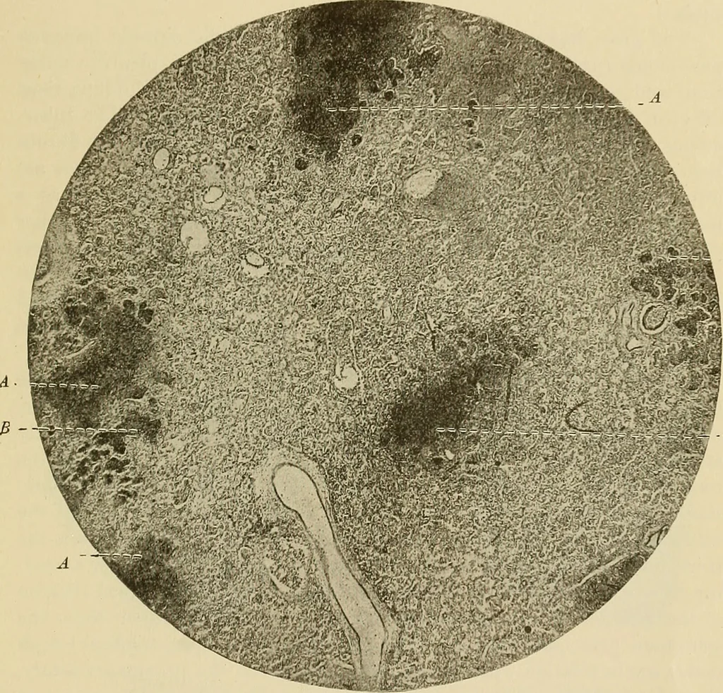 An illustration from The diseases of infancy and childhood : for the use of students and practitioners of medicine / by L. Emmett Holt with two hundred and forty-one illustrations, including eight coloured plates., 1908, leaf 1131