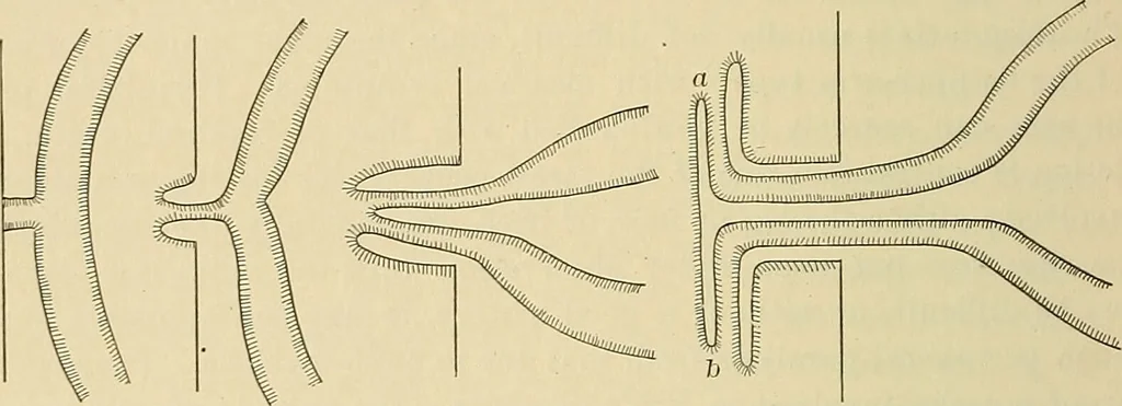 An illustration from The diseases of infancy and childhood : for the use of students and practitioners of medicine / by L. Emmett Holt with two hundred and forty-one illustrations, including eight coloured plates., 1908, leaf 138