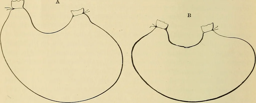 An illustration from The diseases of infancy and childhood : for the use of students and practitioners of medicine / by L. Emmett Holt with two hundred and forty-one illustrations, including eight coloured plates., 1908, leaf 380