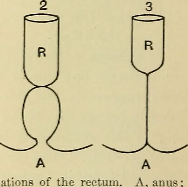 An illustration from The diseases of infancy and childhood : for the use of students and practitioners of medicine / by L. Emmett Holt with two hundred and forty-one illustrations, including eight coloured plates., 1908, leaf 384