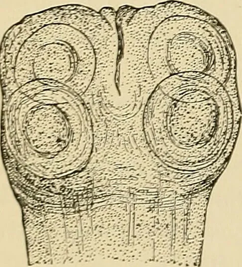 An illustration from The diseases of infancy and childhood : for the use of students and practitioners of medicine / by L. Emmett Holt with two hundred and forty-one illustrations, including eight coloured plates., 1908, leaf 484