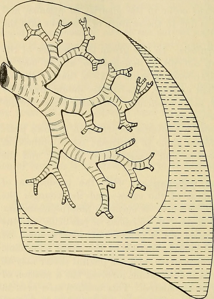 An illustration from The diseases of infancy and childhood : for the use of students and practitioners of medicine / by L. Emmett Holt with two hundred and forty-one illustrations, including eight coloured plates., 1908, leaf 640