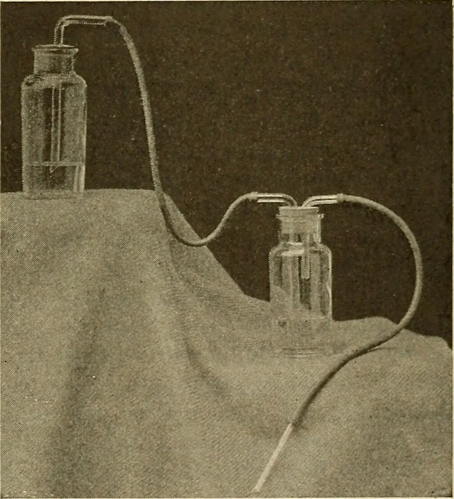 An illustration from The diseases of infancy and childhood : for the use of students and practitioners of medicine / by L. Emmett Holt with two hundred and forty-one illustrations, including eight coloured plates., 1908, leaf 647