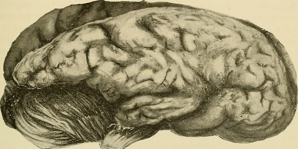 An illustration from The diseases of infancy and childhood : for the use of students and practitioners of medicine / by L. Emmett Holt with two hundred and forty-one illustrations, including eight coloured plates., 1908, leaf 841