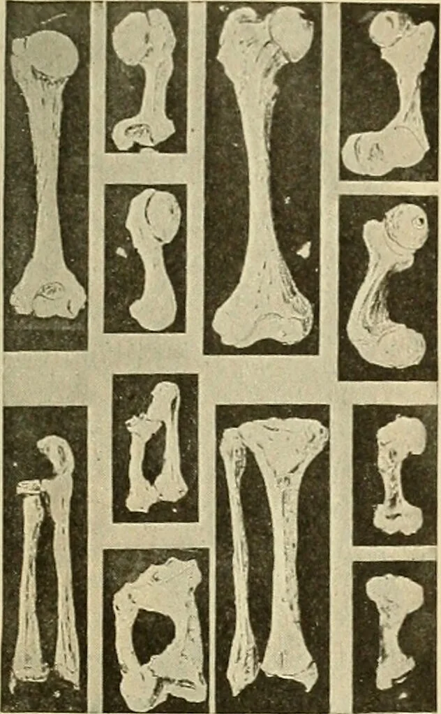 An illustration from The diseases of infancy and childhood : for the use of students and practitioners of medicine / by L. Emmett Holt with two hundred and forty-one illustrations, including eight coloured plates., 1908, leaf 855