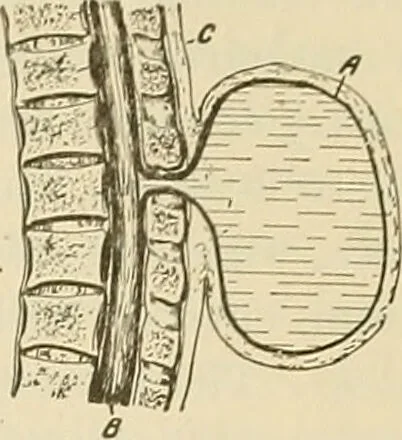 An illustration from The diseases of infancy and childhood : for the use of students and practitioners of medicine / by L. Emmett Holt with two hundred and forty-one illustrations, including eight coloured plates., 1908, leaf 865
