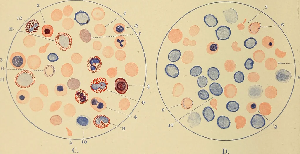 An illustration from The diseases of infancy and childhood : for the use of students and practitioners of medicine / by L. Emmett Holt with two hundred and forty-one illustrations, including eight coloured plates., 1908, leaf 902