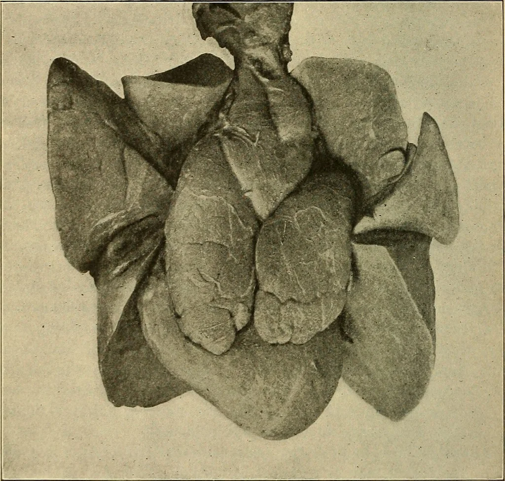 An illustration from The diseases of infancy and childhood : for the use of students and practitioners of medicine / by L. Emmett Holt with two hundred and forty-one illustrations, including eight coloured plates., 1908, leaf 926