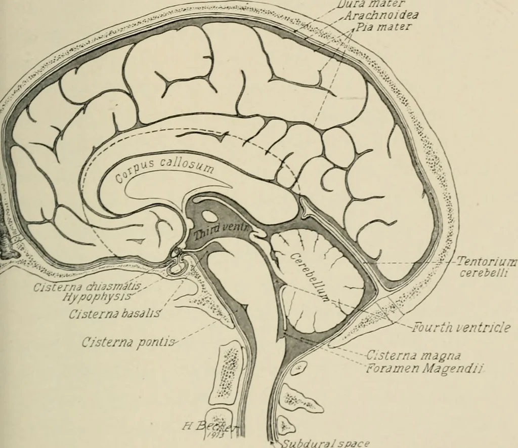 An illustration from Meningococcus meningitis / by Henry Heiman ... and Samuel Feldstein ... with introduction by Henry Koplik ... with 4 plates, 31 figures, 2 in color, and 4 charts., 1913, leaf 103