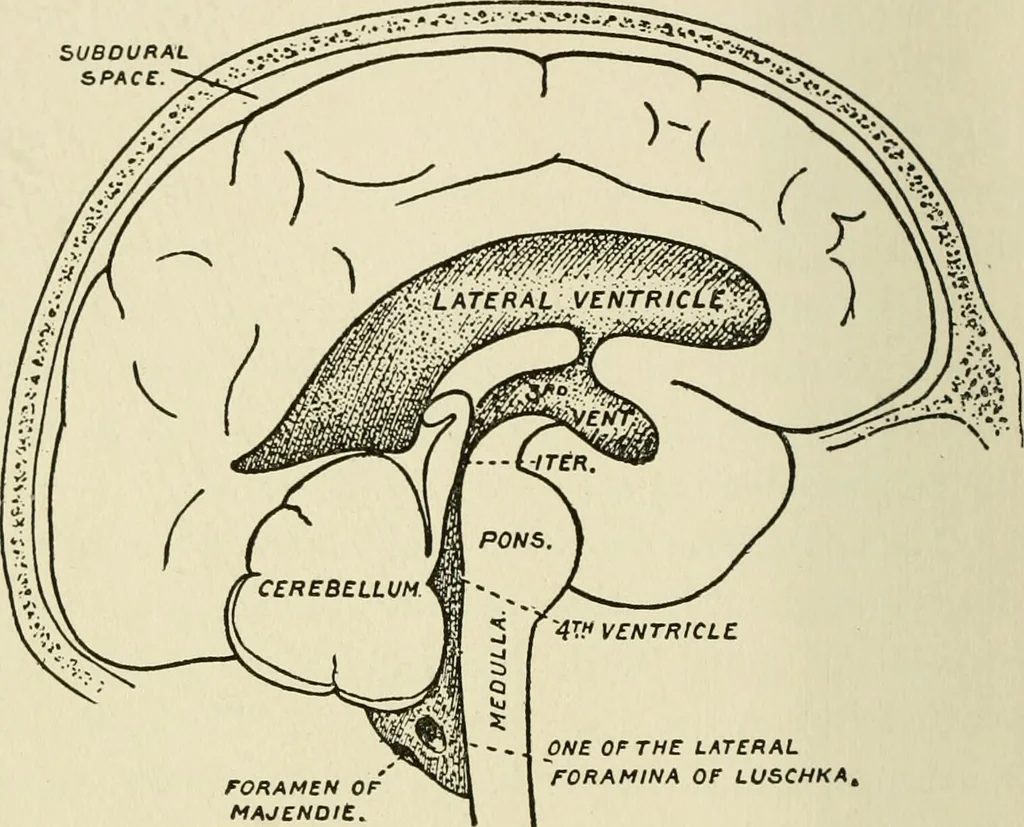 An illustration from Meningococcus meningitis / by Henry Heiman ... and Samuel Feldstein ... with introduction by Henry Koplik ... with 4 plates, 31 figures, 2 in color, and 4 charts., 1913, leaf 106