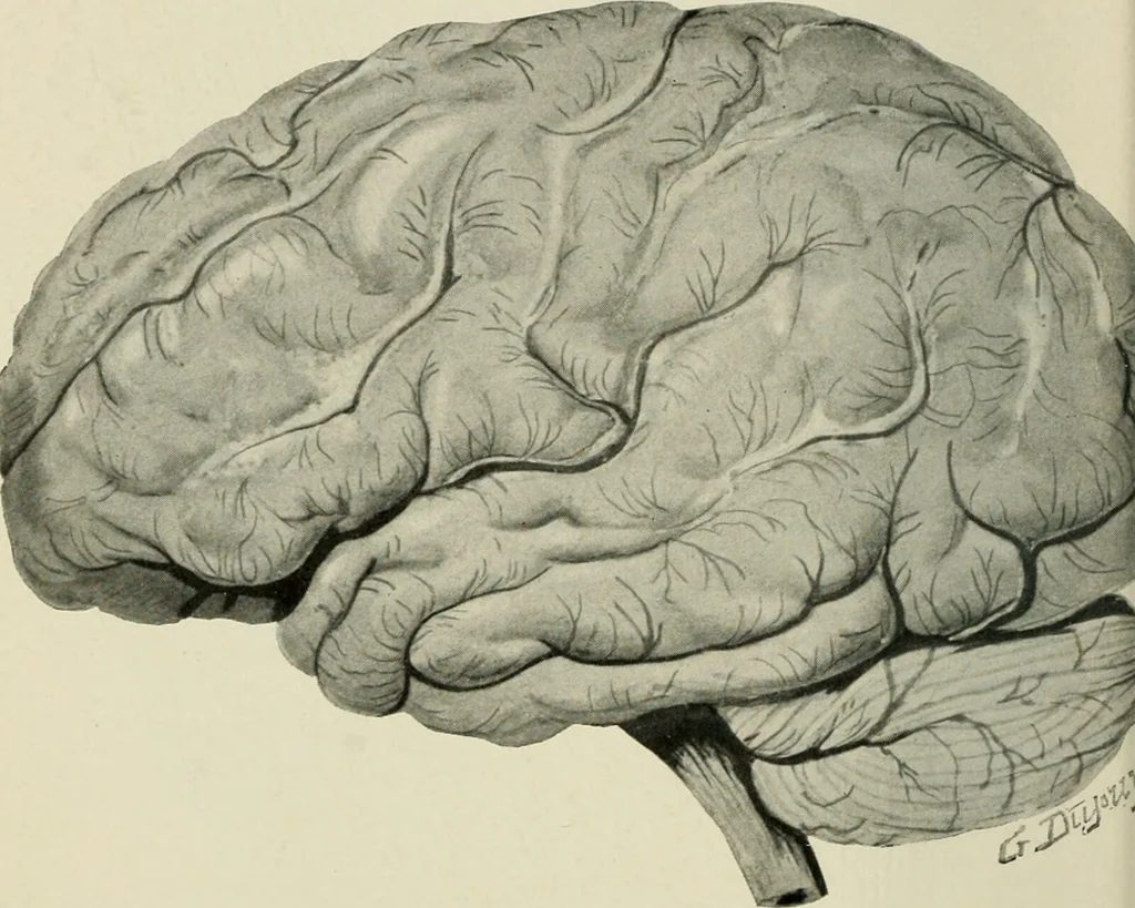 An illustration from Meningococcus meningitis / by Henry Heiman ... and Samuel Feldstein ... with introduction by Henry Koplik ... with 4 plates, 31 figures, 2 in color, and 4 charts., 1913, leaf 108