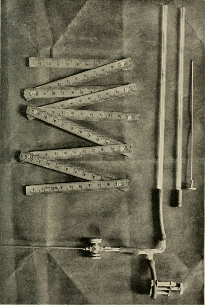 An illustration from Meningococcus meningitis / by Henry Heiman ... and Samuel Feldstein ... with introduction by Henry Koplik ... with 4 plates, 31 figures, 2 in color, and 4 charts., 1913, leaf 195