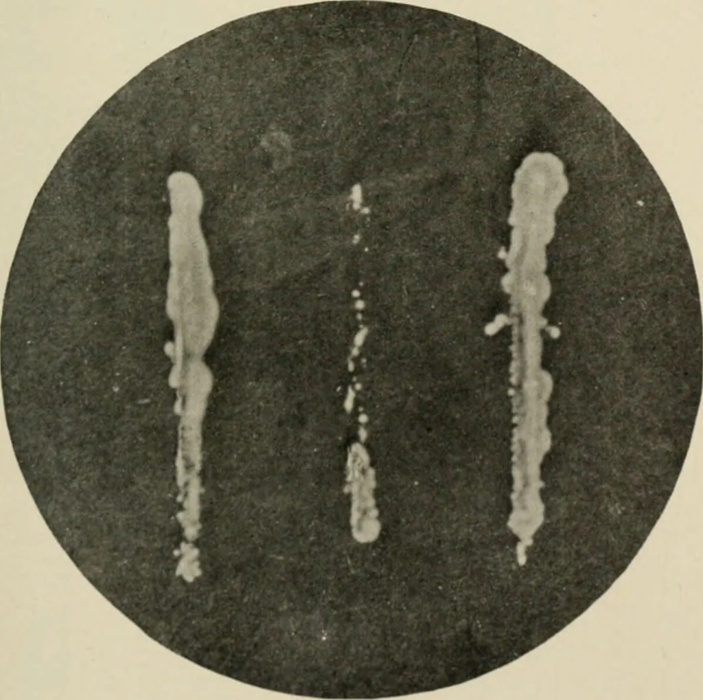 An illustration from Meningococcus meningitis / by Henry Heiman ... and Samuel Feldstein ... with introduction by Henry Koplik ... with 4 plates, 31 figures, 2 in color, and 4 charts., 1913, leaf 43