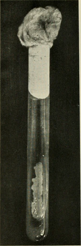 An illustration from Meningococcus meningitis / by Henry Heiman ... and Samuel Feldstein ... with introduction by Henry Koplik ... with 4 plates, 31 figures, 2 in color, and 4 charts., 1913, leaf 44