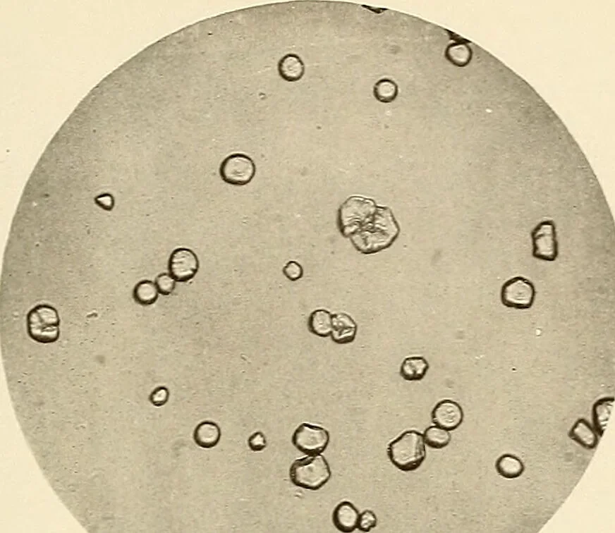 An illustration from A manual of practical hygiene for students, physicians, and health officers / By Charles Harrington., 1914, leaf 221