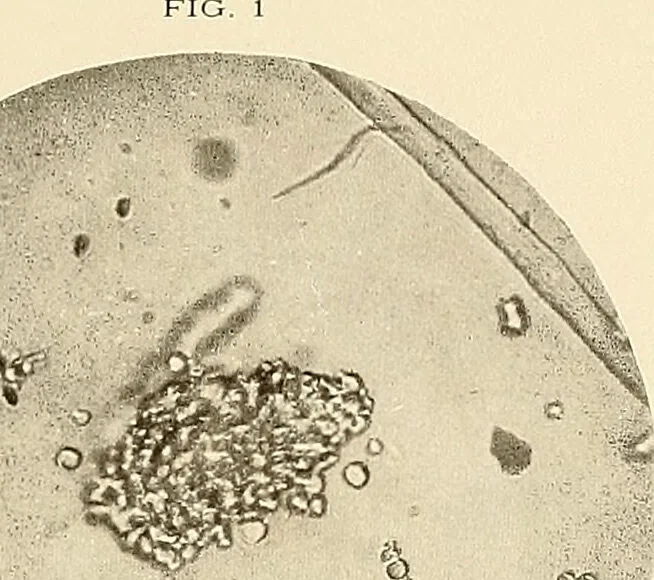An illustration from A manual of practical hygiene for students, physicians, and health officers / By Charles Harrington., 1914, leaf 225