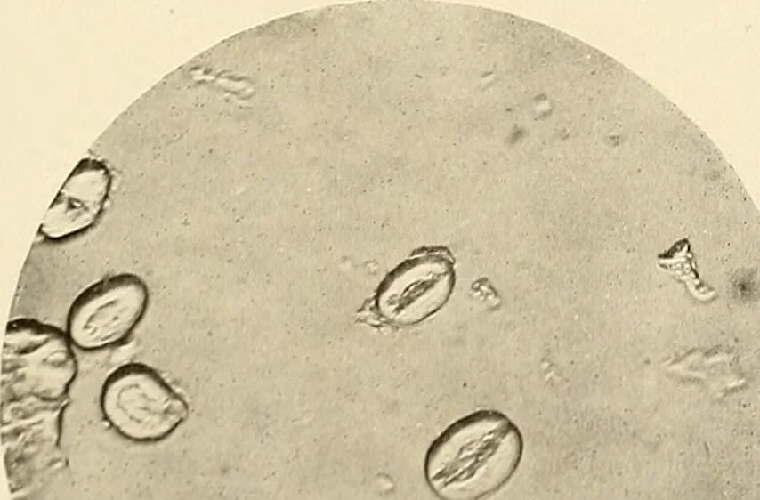 An illustration from A manual of practical hygiene for students, physicians, and health officers / By Charles Harrington., 1914, leaf 225